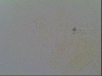Pseudechiniscus ramazzottii facettalis image