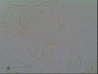 Pseudechiniscus ramazzottii facettalis image