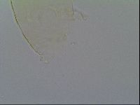 Pseudechiniscus ramazzottii image