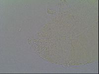 Pseudechiniscus ramazzottii image