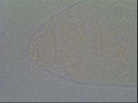 Pseudechiniscus ramazzottii facettalis image