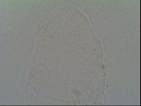 Pseudechiniscus ramazzottii facettalis image