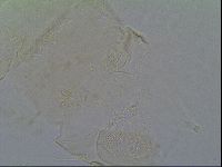 Pseudechiniscus ramazzottii image
