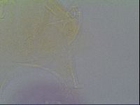 Pseudechiniscus ramazzottii image