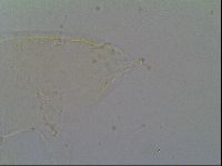 Pseudechiniscus ramazzottii image