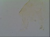 Pseudechiniscus ramazzottii facettalis image