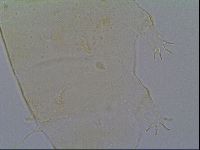 Pseudechiniscus ramazzottii image