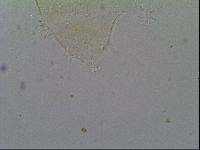Pseudechiniscus ramazzottii image