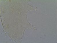 Pseudechiniscus ramazzottii facettalis image