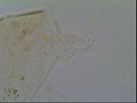 Pseudechiniscus ramazzottii facettalis image