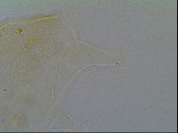 Pseudechiniscus ramazzottii facettalis image