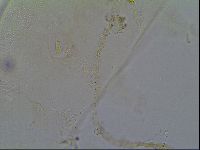 Pseudechiniscus ramazzottii image