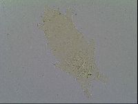 Pseudechiniscus ramazzottii image