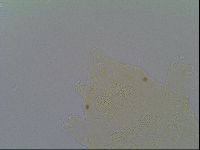 Pseudechiniscus ramazzottii image