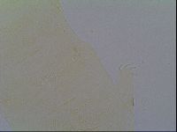 Pseudechiniscus ramazzottii facettalis image