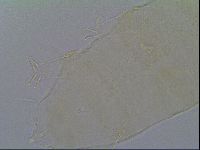 Pseudechiniscus ramazzottii image