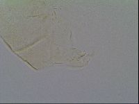Pseudechiniscus suillus image