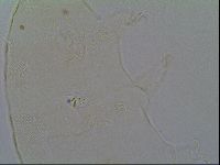 Pseudechiniscus suillus image