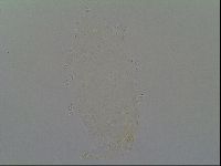 Pseudechiniscus ramazzottii image