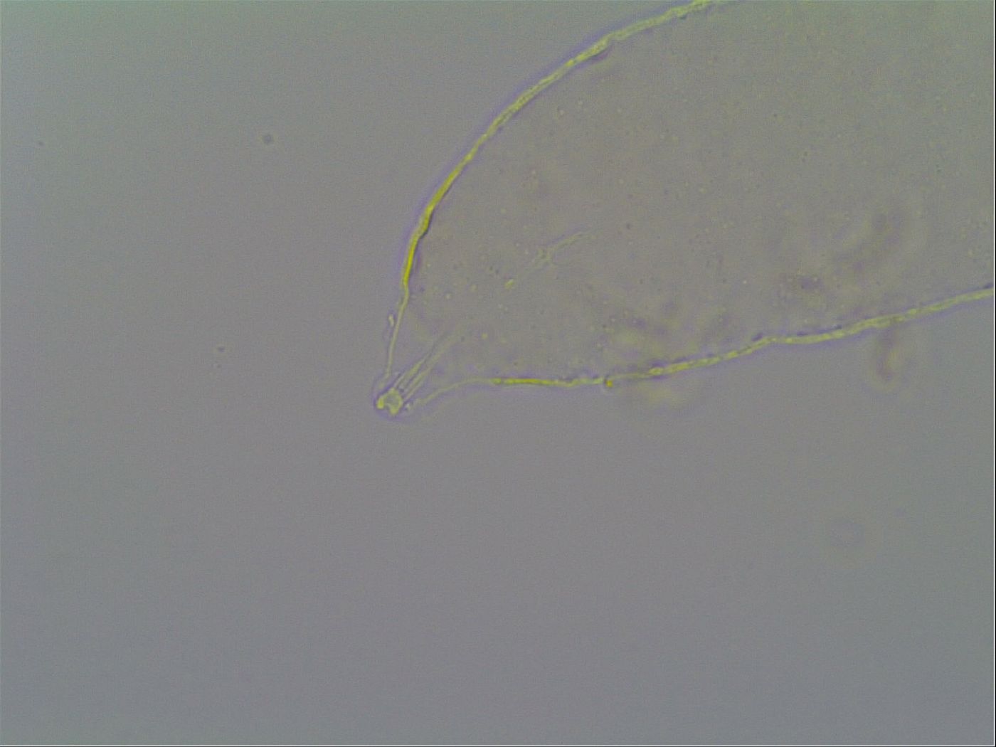 Pseudechiniscus suillus image