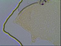 Pseudechiniscus ramazzottii image