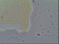 Pseudechiniscus ramazzottii image