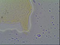 Pseudechiniscus ramazzottii facettalis image