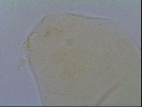 Pseudechiniscus suillus image