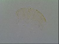 Pseudechiniscus suillus image