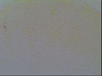 Pseudechiniscus suillus image