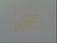 Pseudechiniscus suillus image