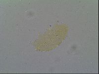 Pseudechiniscus suillus image