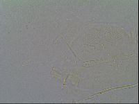 Pseudechiniscus suillus image