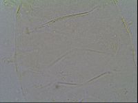 Pseudechiniscus suillus image