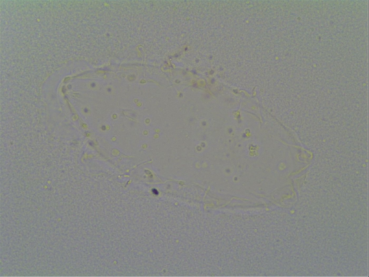 Pseudechiniscus suillus image