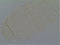 Pseudechiniscus suillus image