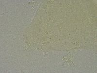 Pseudechiniscus suillus image