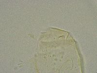 Pseudechiniscus suillus image