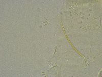 Pseudechiniscus suillus image