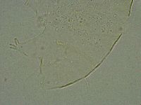 Pseudechiniscus suillus image