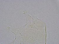 Pseudechiniscus suillus image