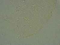 Pseudechiniscus suillus image