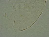 Pseudechiniscus suillus image