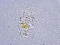 Pseudechiniscus suillus image
