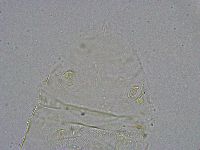 Pseudechiniscus suillus image