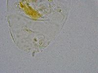 Pseudechiniscus suillus image