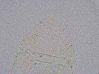 Pseudechiniscus suillus image