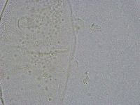 Pseudechiniscus suillus image