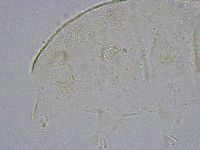 Pseudechiniscus suillus image