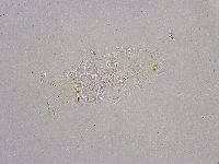 Pseudechiniscus suillus image